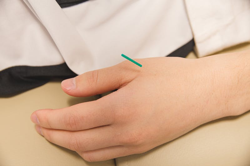 PEMF לדלקת בגיד אכילס — טיפול בפולסים אלקטרומגנטיים | PainFree