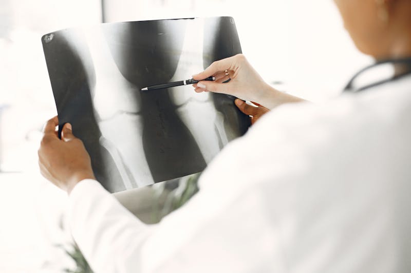 רופא בוחן צילום רנטגן של רגל — PEMF של PainFree לפציעת אדוקטור | PainFree