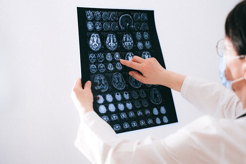 PEMF, נוירו-דלקת ופוסט-טראומה — רופא בוחן דימות MRI של המוח | PainFree