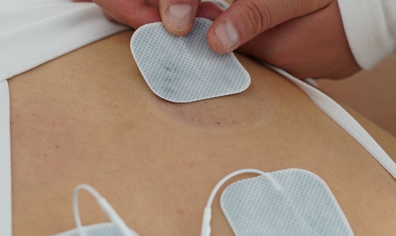 PEMF של חברת PainFree לעומת TENS — השוואה קלינית מקצועית | PainFree