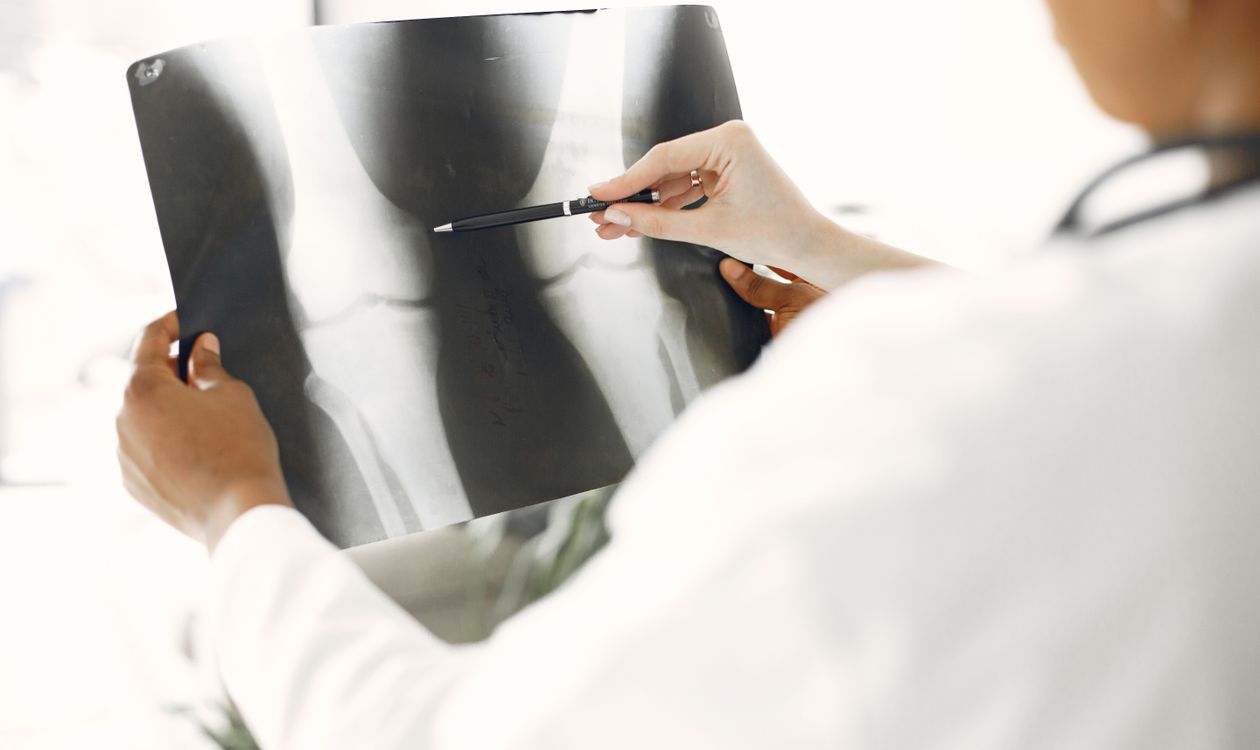 רופא בוחן צילום רנטגן של רגל — PEMF של PainFree לפציעת אדוקטור | PainFree